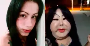 Trans que aplicou silicone nas bochechas procura ajuda médica