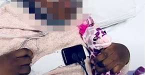 Norte-americana é acusada de submeter filha adotiva a cirurgia desnecessária