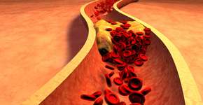 Harvard revela 5 alimentos que ajudam a reduzir colesterol ruim