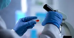 Variante genética pode restringir a replicação do HIV, diz pesquisa