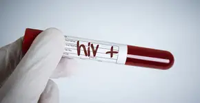 Descoberta variante genética que parece limitar a infecção pelo HIV