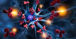 Foto: (peterschreiber.media/istock)