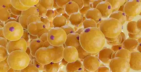 Gordura oculta pode sinalizar Alzheimer 20 anos antes dos sintomas aparecerem