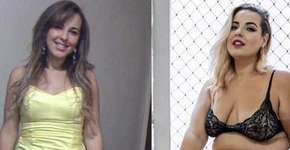 Influenciadora revela lado negativo da bariátrica em antes e depois