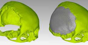 Foto: (Imagem sem texto alternativo disponivel ID [1833787])