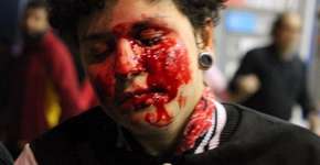 Foto: (Imagem sem texto alternativo disponivel ID [1132861])