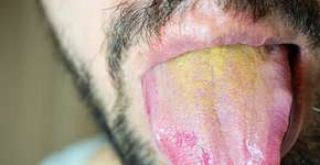 Foto: (jockermax/istock)