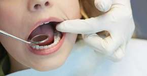 Dentistas usam novas formas de tratar cárie sem o motorzinho