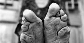 Foto: (Imagem sem texto alternativo disponivel ID [643367])