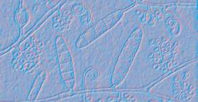 Foto: (katerynakon/Deposit Photos)