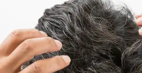 Adeus aos cabelos brancos? Estudo revela vitamina que ajuda a reverter os fios grisalhos