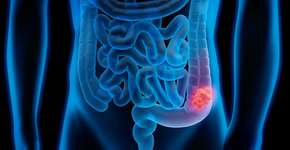 Foto: (peterschreiber.media/istock)