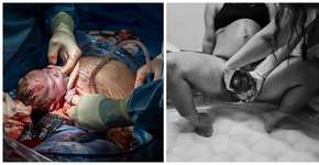 Organização elege as melhores fotos de parto feitas em 2016