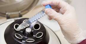 Estudo apresenta anticoncepcional masculino com 99% de eficácia