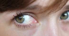 Foto: (zoteva87/DepositPhotos)