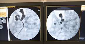 Foto: (bfk92/istock)