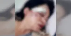 Mulher é espancada por vizinhos por causa de som alto em SP