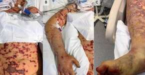 Foto: (NEW ENGLAND JOURNAL OF MEDICINE)