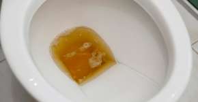 Foto: (Sidney de Almeida/istock)