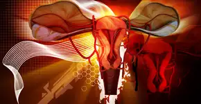 Condição comum aumenta risco de desenvolver câncer de endométrio