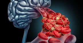 Foto: (wildpixel/istock)