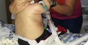 Morre bebê que teve dinheiro de tratamento desviado pelo pai