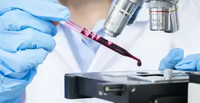 Foto: (Kunlathida Petchuen/istock)