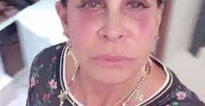 Foto: (Imagem sem texto alternativo disponivel ID [1551374])