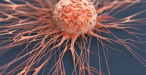 Você conhece os sintomas do câncer de pulmão em não fumantes? Veja os 12 principais