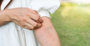 Foto: (Pattarisara Suvichanarakul/istock)