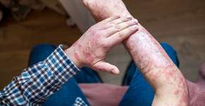 Foto: (iStock/200mm)