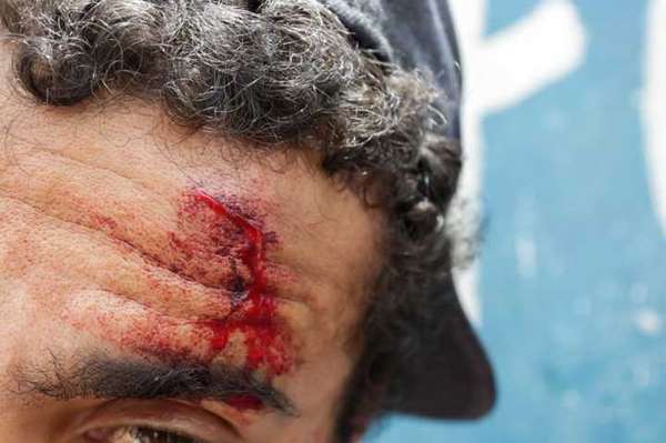 As agressões aos moradores da cracolândia são frequentes