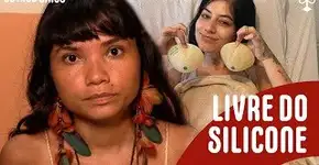 Famosas retiram o silicone e abrem discussão sobre o movimento de desprendimento da prótese de mama