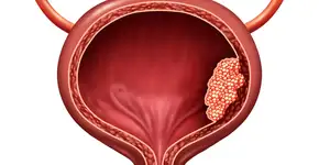 Foto: (lightsource/DepositPhotos)