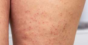 Foto: (iSTock/sruilk)