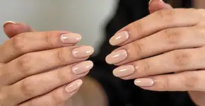 Foto: (Imagem sem texto alternativo disponivel ID [2732531])