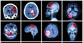 Foto: (stockdevil_666/DepositPhotos)