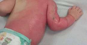 Foto: (Imagem sem texto alternativo disponivel ID [1703350])