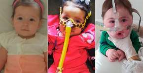 AME: as famílias que lutam pelo remédio mais caro do mundo