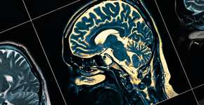 Foto: (sudok1/istock)