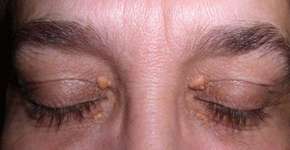 Foto: (Imagem sem texto alternativo disponivel ID [1620703])