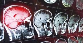 Foto: (Depositphotos/katmoy)