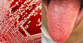 Foto: (istock/New England Journal of Medicine)