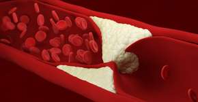 Foto: (bodym/istock)