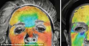 Foto: (© Perelman School of Medicine/UPenn)