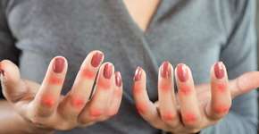 Foto: (iStock/Doucefleur)