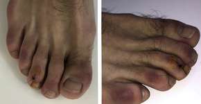 Foto: (Jornal da Academia Americana de Dermatologia PA)