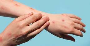 Foto: (Marina Demidiuk/istock)