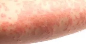 Foto: (iStock/gokhanilgaz)