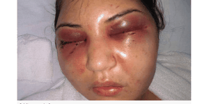 Foto: (Imagem sem texto alternativo disponivel ID [1706958])